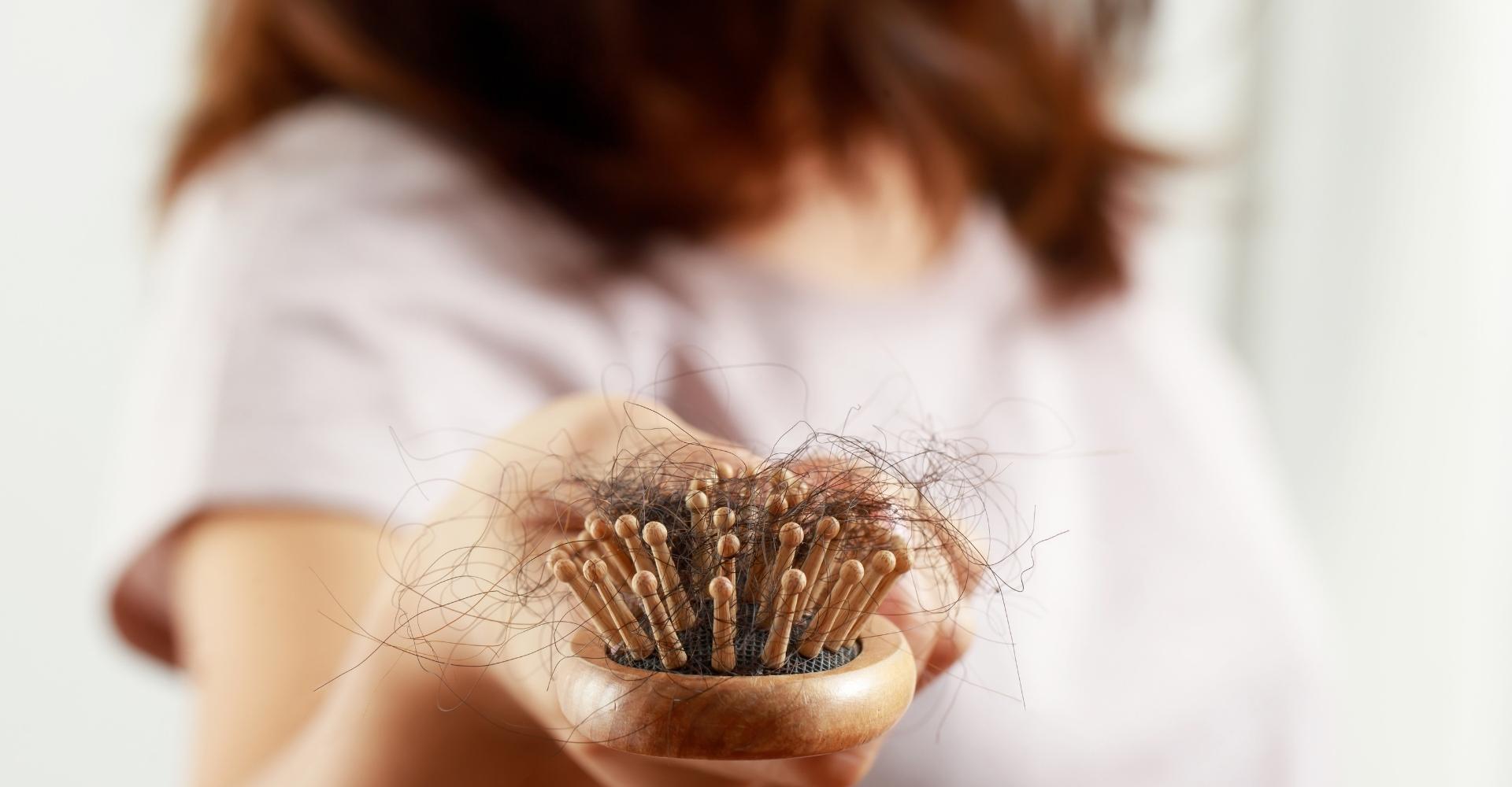 Saç Dökülmesi Nedenleri Nelerdir?